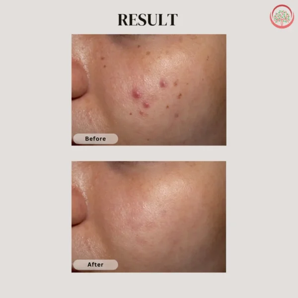 ilika ceramide gel moisturizer