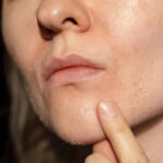Hyaluronic acid serum