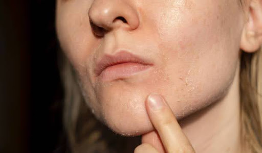 Hyaluronic acid serum