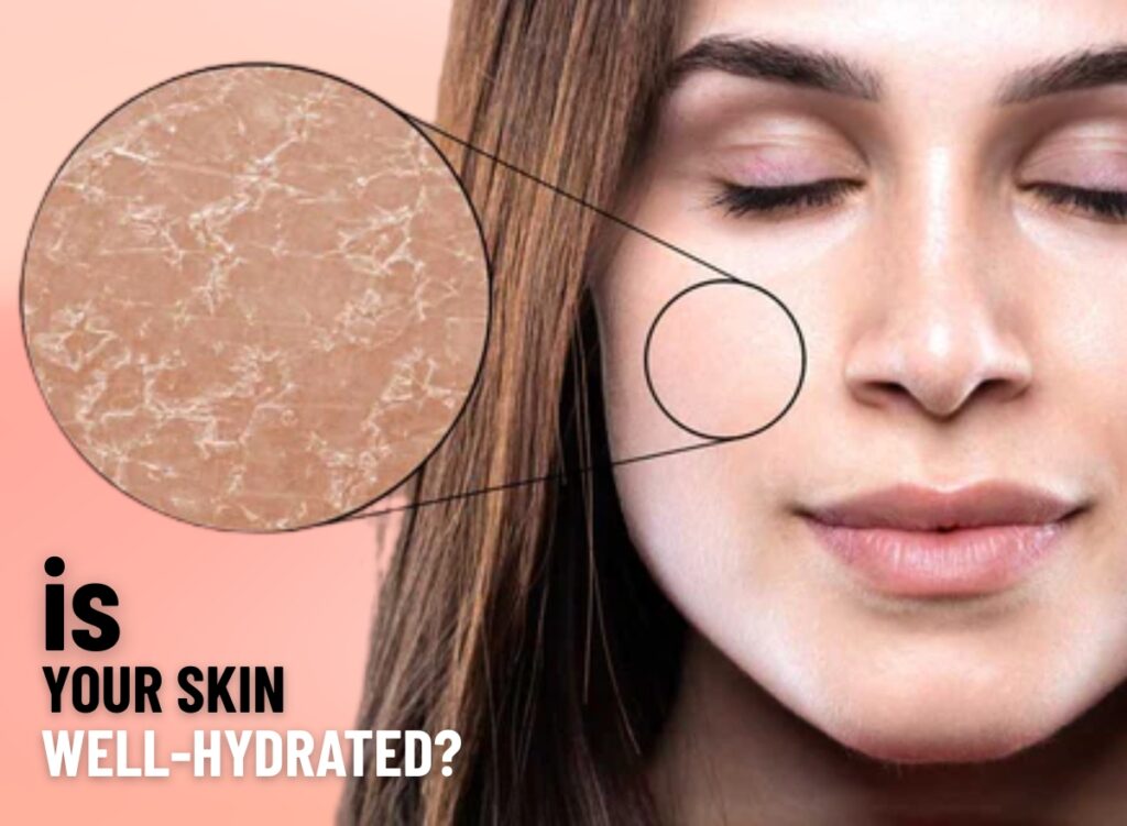hydra gel